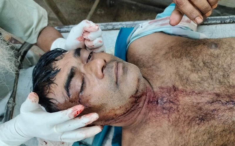 শার্শায় টাকা চুরি নিয়ে বিরোধে এক ব্যক্তি আহত